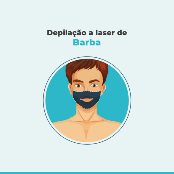 Depilação a laser de Barba