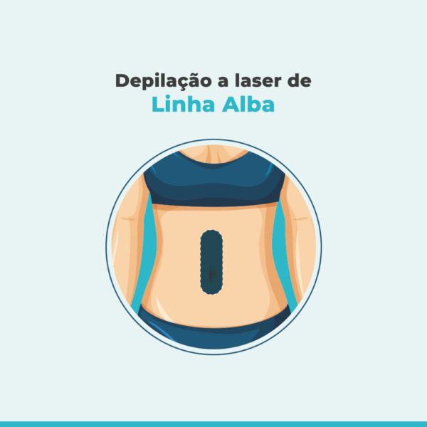 Depilação a laser de Linha Alba